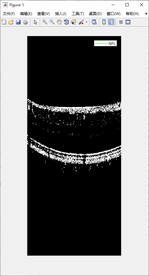 retina-image-segmentation-10.png