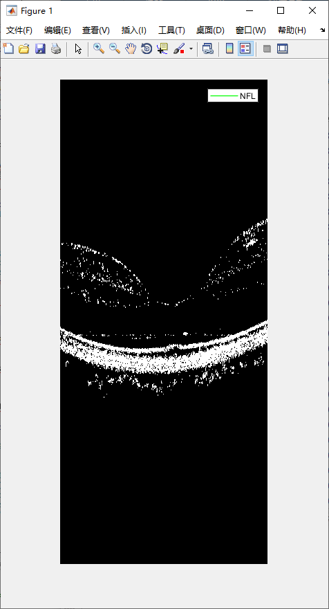 retina-image-segmentation-11.png