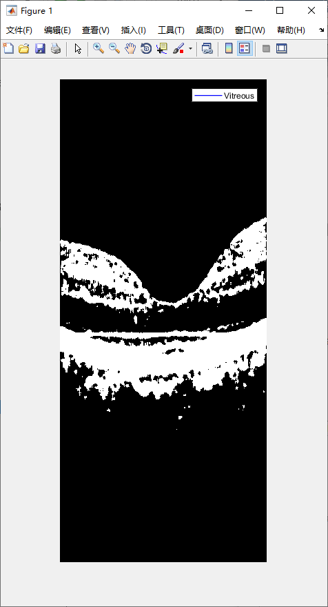 retina-image-segmentation-3.png