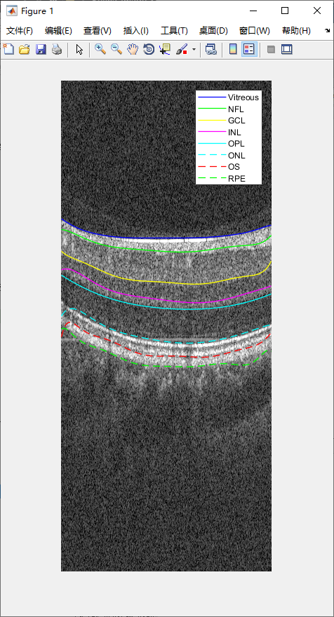 retina-image-segmentation-33.png