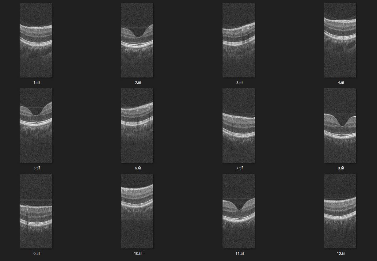 retina-image-segmentation-1.png