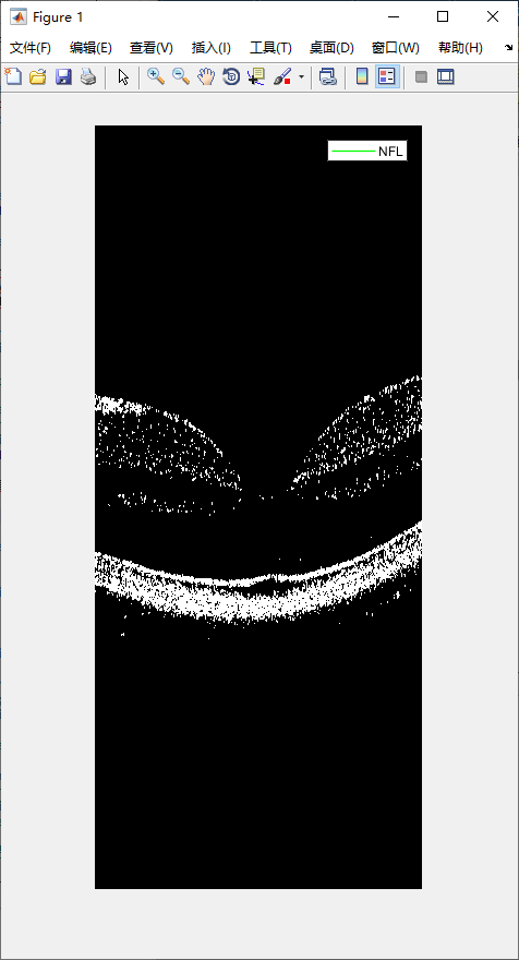 retina-image-segmentation-12.png