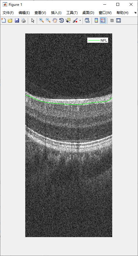 retina-image-segmentation-19.png