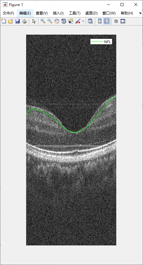 retina-image-segmentation-20.png