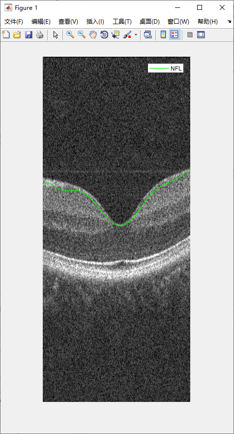 retina-image-segmentation-21.png