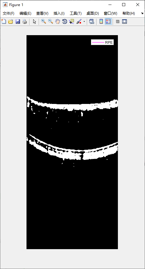 retina-image-segmentation-22.png