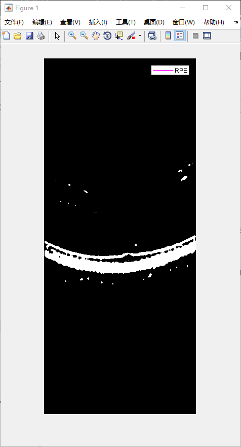 retina-image-segmentation-23.png