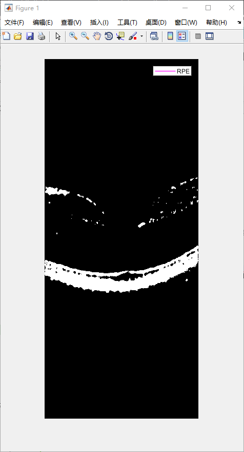 retina-image-segmentation-24.png