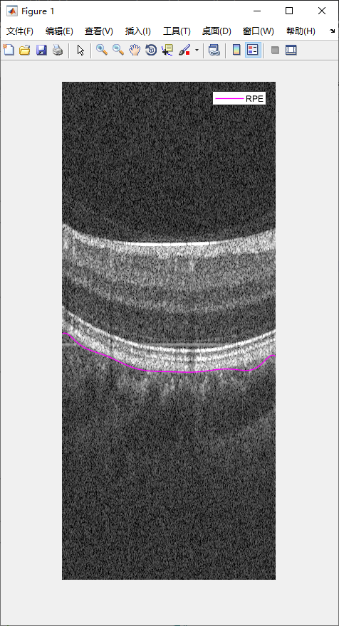 retina-image-segmentation-28.png
