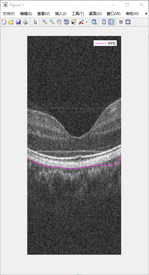 retina-image-segmentation-29.png