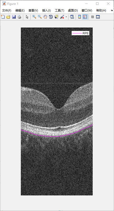 retina-image-segmentation-30.png