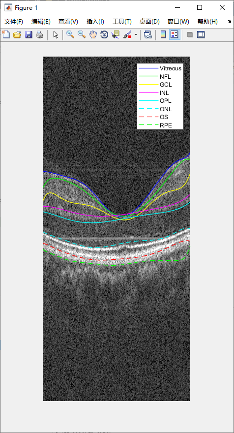 retina-image-segmentation-34.png