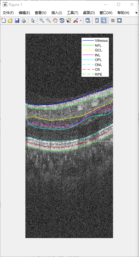 retina-image-segmentation-35.png