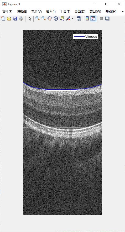 retina-image-segmentation-7.png