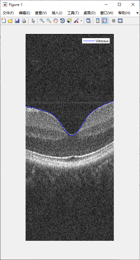 retina-image-segmentation-9.png